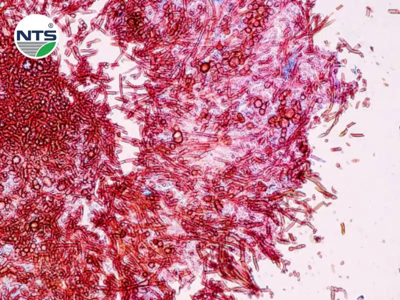 Hình ảnh thumnail các con giun đỏ trong nước thải sinh hoạt